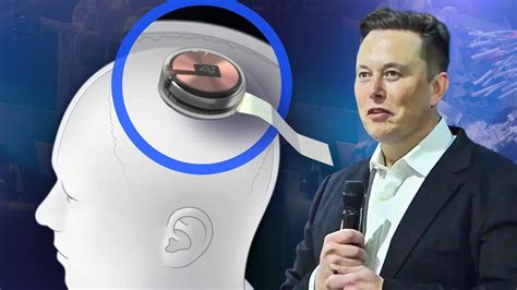 rfid human chip investments|Elon Musk's Neuralink Has Implanted Its First Chip in a Human .